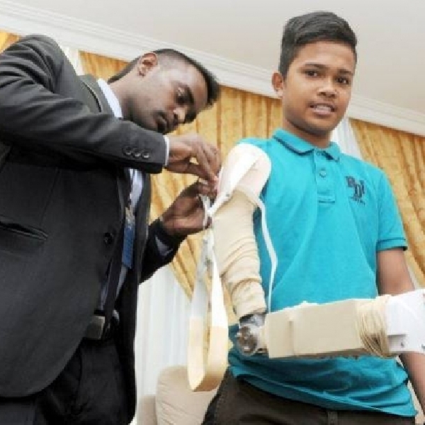 Ilmuwan Malaysia Berhasil Tanam Lengan Robotik Rendah Biaya