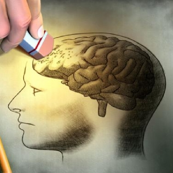 Ilmuwan Temukan Cara Hapus Memori Otak Manusia